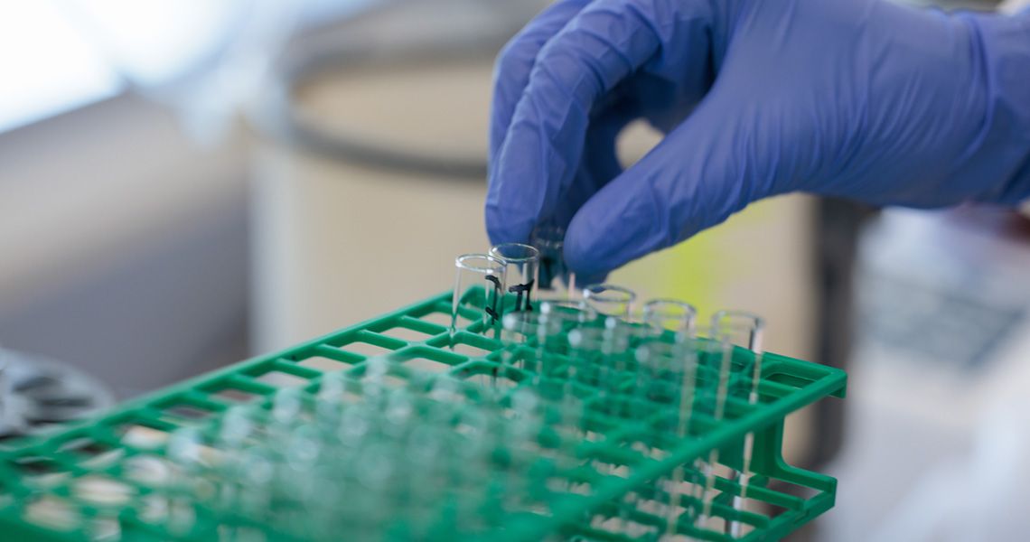 Blood Bank Test Tubes
